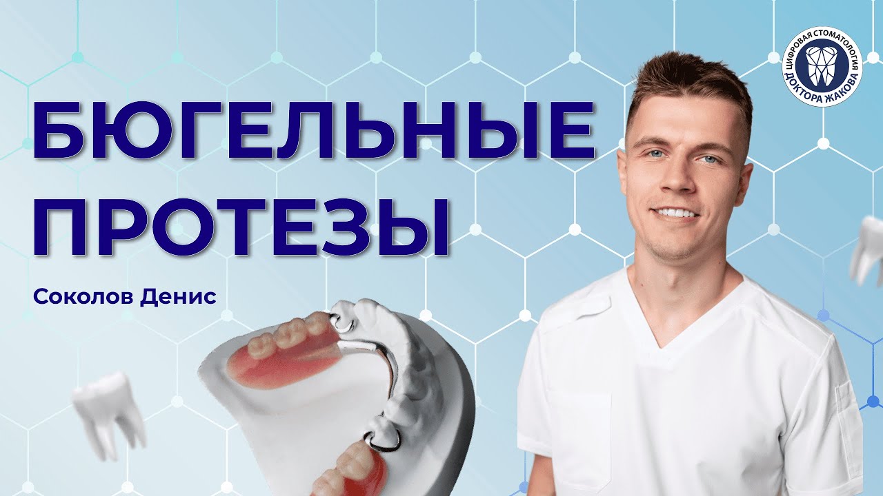 Бюгельные протезы. Что это такое?