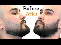 تعلم تدريج اللحية بدون استعمال الصبغة / فيديو مهم جدآ لعشاق اللحية الطبيعة Beard before and after