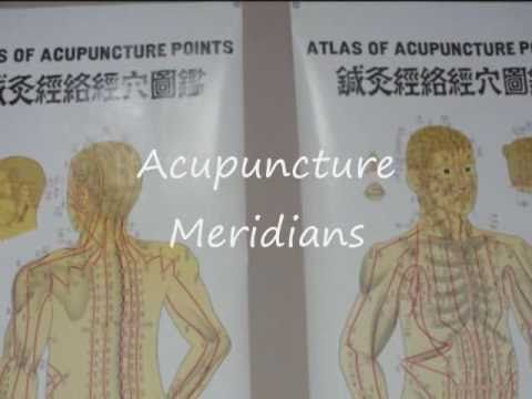 Acupuncture - Dr. Craig Schadow, Coon Rapids, Minn...