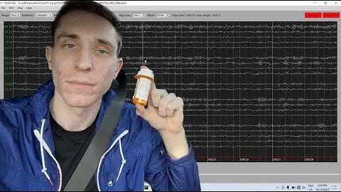 Medication Effects on EEG 🧠💊