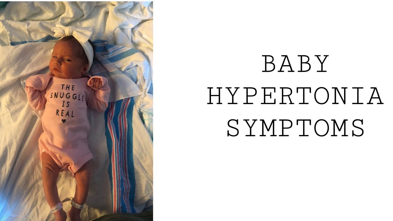 Baby Hypertonia Symptoms YouTube