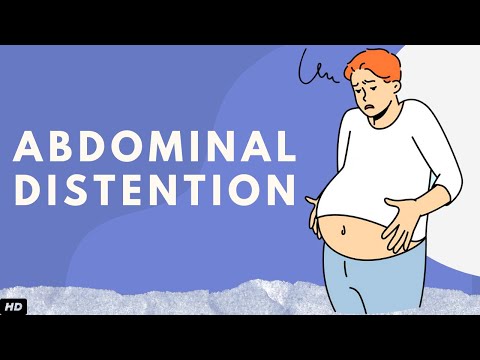 Abdominal Distention: Everything You Need To Know
