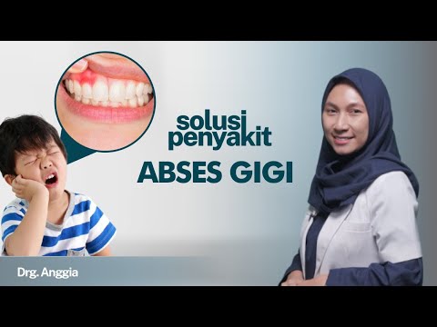 Video: Siapa yang merawat gigi abses?