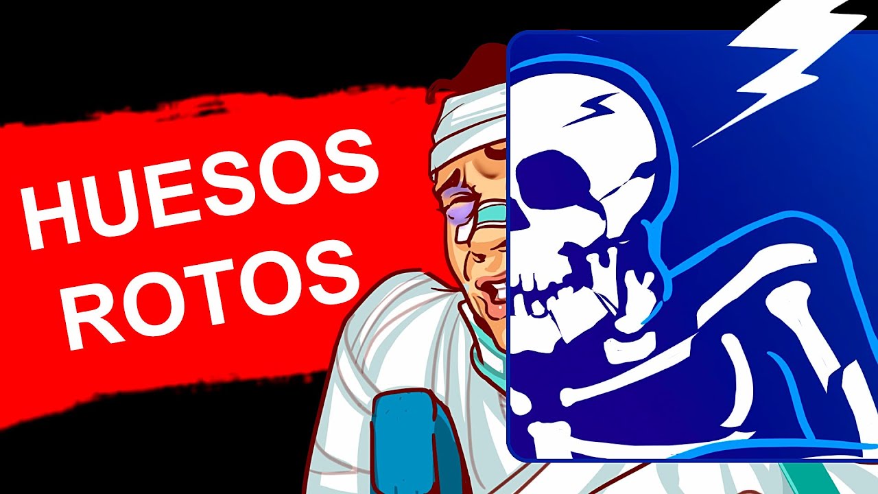 Qu sucede cuando te rompes los brazos y las piernas