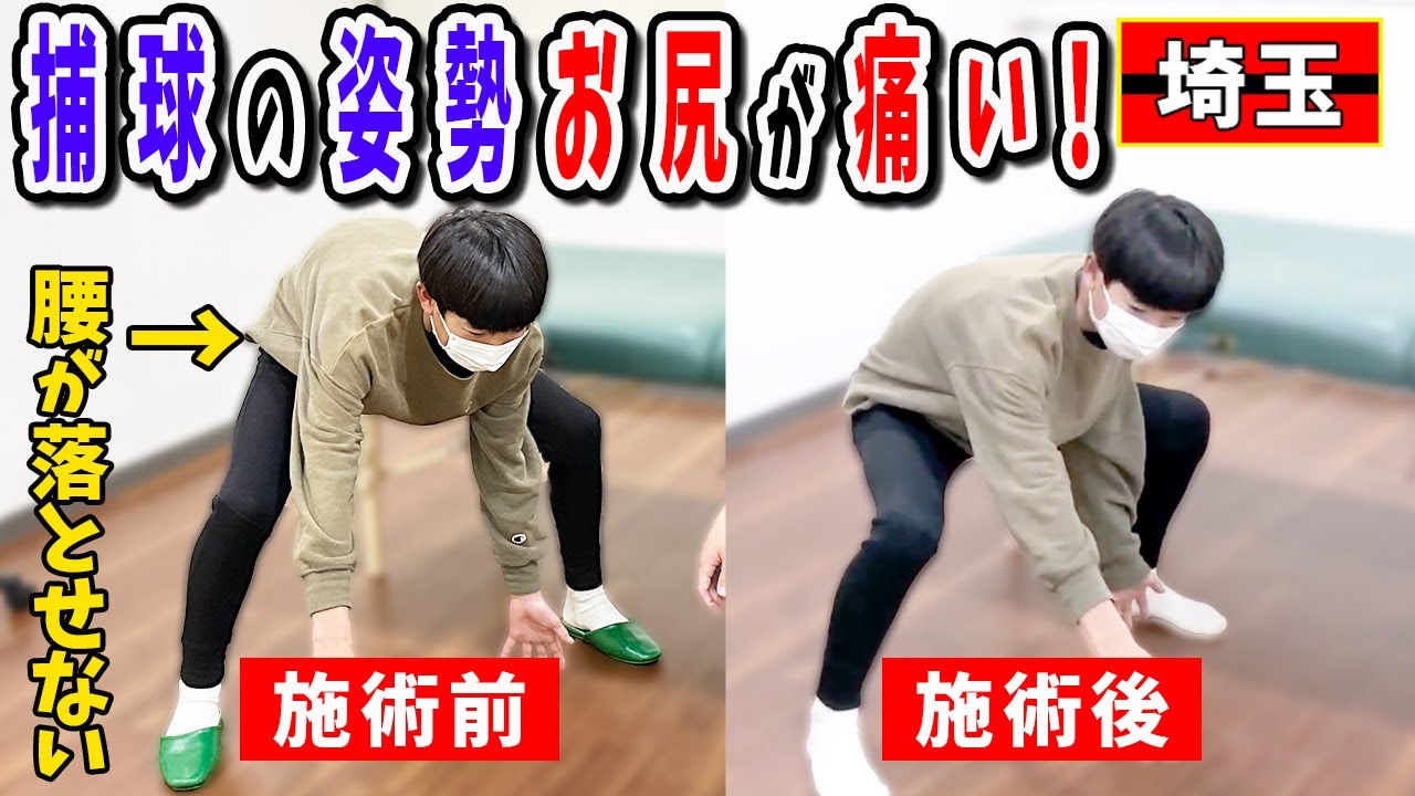 【野球 捕球】捕球の姿勢でお尻の痛み！野球少年のお尻の痛みは意外なモノの取り過ぎで！埼玉県川口市きむら鍼灸整骨院