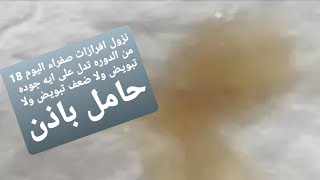 نزول افرازات صفراء ايام التبويض يدل على ايه التهابات ولا حمل باذن الله تعالى