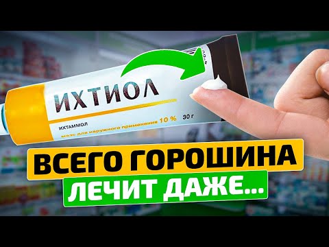 Производитель утаил правду! Если использовать так... Ихтиоловая мазь (ихтиол)