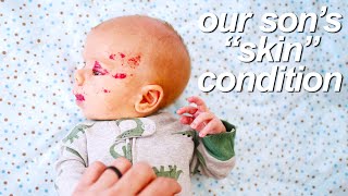 &quot;What&#39;s Wrong with Your Baby&#39;s Face??&quot; (addressing comments about our newborn son&#39;s hemangiomas)