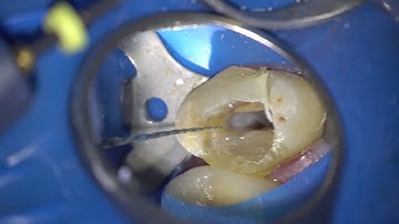 Strictly tactile controlled activation EDM shaping