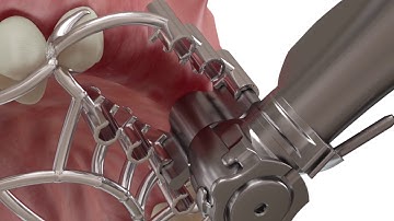 Guide 2Ingis. Protocol.