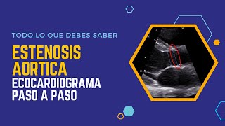 Estenosis Aortica Ecocardiograma Paso A Paso