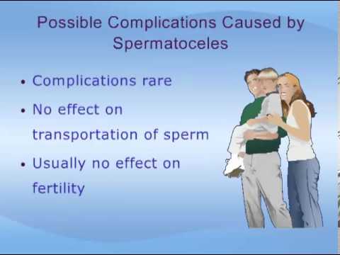 Spermatoceles