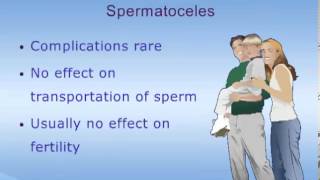 Detailed Spermatoceles Details