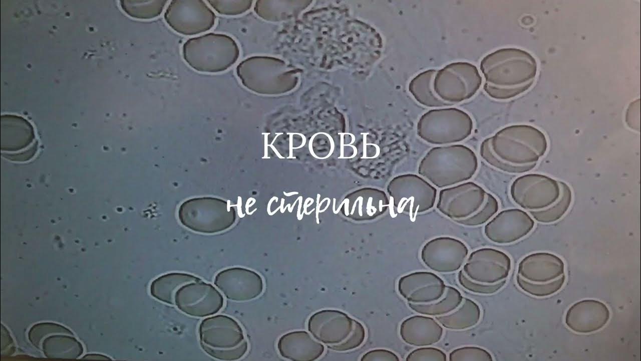 Поворот судьбы кровь не водица