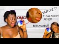 OMG! THIS IS WHAT HAPPENED WHEN I USED VASELINE ON MY FACE FOR ONE WEEK |IS VASELINE GOOD FOR FACE