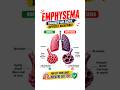 Emphysema Explained: Damaged Alveoli &amp; Breathlessness #lungs #medical #biology #shorts