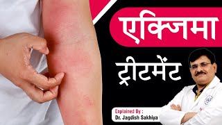 एक्जिमा ट्रीटमेंट  Treatment | How to get rid of Eczema | Sakhiya Skin Clinic | Dr Jagdish Sakhiya screenshot 4