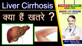 Liver Cirrhosis क्या हैं ख़तरे ? || COMPLICATIONS  OF CIRRHOSIS