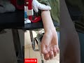 سحب دم بطريقة احترافية Phlebotomy شرح عملي ونصائح للتمريض 