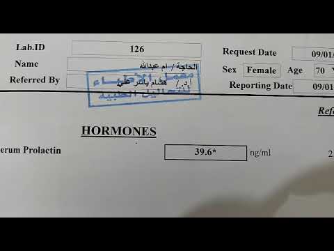 تحليل هرمون الحليب  ارتفاع التحليل ليس عقم بأذن الله
