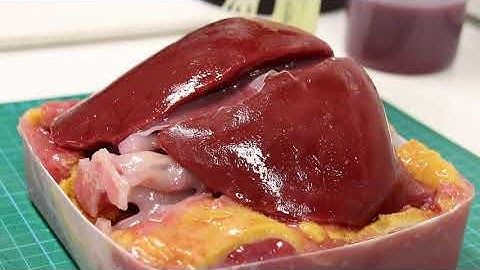 3D-printed liver to help surgeons prepare for life-saving operations developed by researchers at NTU