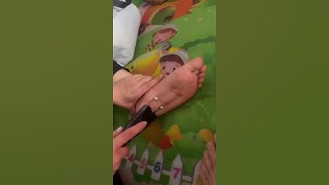 Lý do cạo gió cả tháng vẫn còn đen   Cạo gió bạc Bách Chi