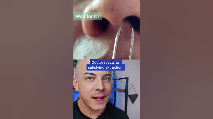 Doctor reacts to extremely satisfying pimple pop! #usegloves #dermreacts #pimplepop #pimplepopper