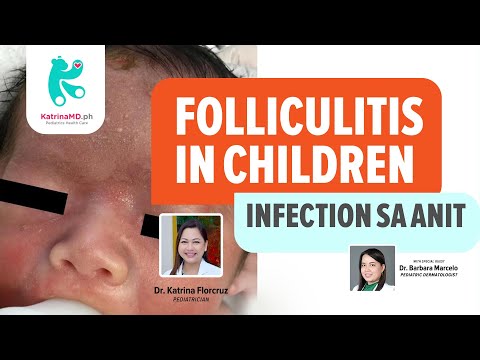 Folliculitis in Children (Skin Infection sa Anit)