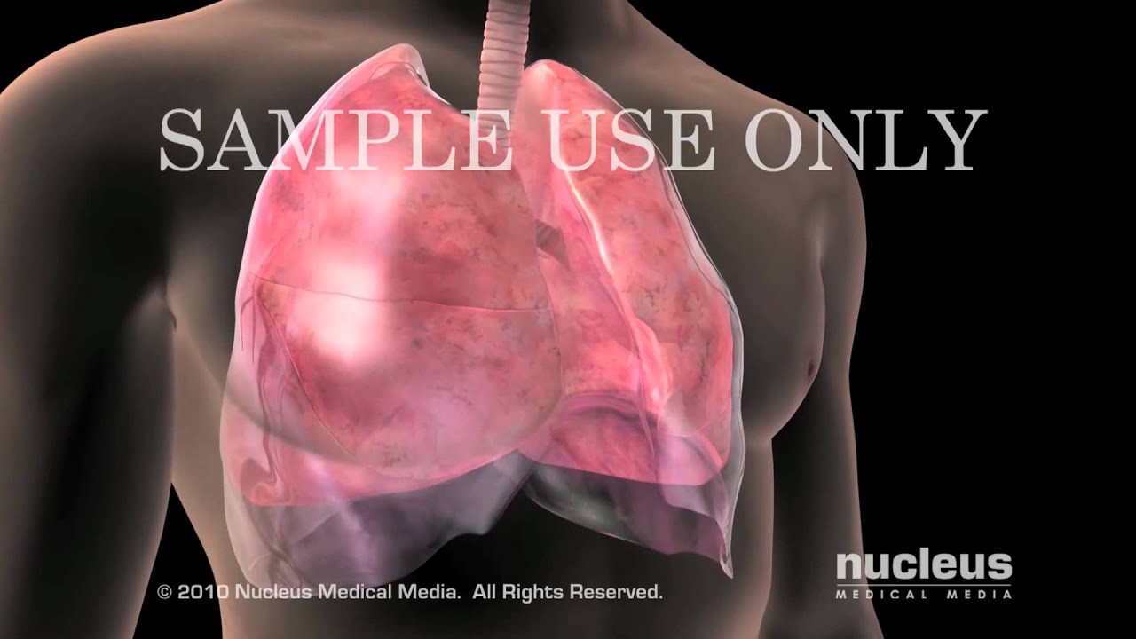 Lung Anatomy - YouTube