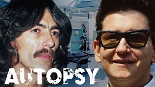 What Caused The Deaths Of George Harrison And Roy Orbison? | Our History