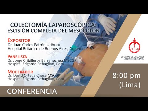 Vídeo: Cirugía Robótica Versus Laparoscópica Para El Cáncer De Recto En La Preservación De La Función Urogenital Masculina, Un Metanálisis