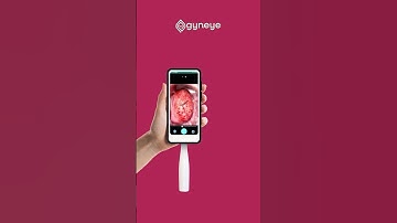 Comprehensive Wellness Screening with Gyneye Portable Colposcope