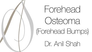 Forehead Osteoma (Forehead Bumps)
