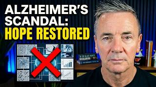 The Alzheimer's Deception Nobody Saw Coming