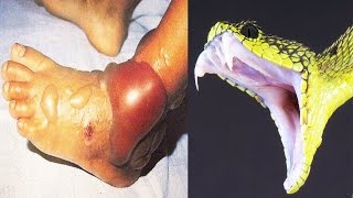 10 САМЫХ ЯДОВИТЫХ ЖИВОТНЫХ В МИРЕ! 10 САМЫХ ЯДОВИТЫХ ЖИВОТНЫХ В МИРЕ!