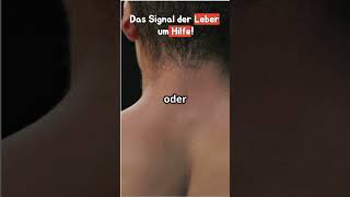 Das Signal Der Leber Um Hilfe  Diese Zeichen Ignorieren Die Meistenleber gesundheit