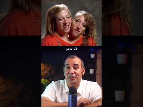 توأم ملتصقين يتزوجون رجل واحد 
