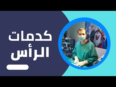 فيديو: هل كدمات المخ خطيرة؟