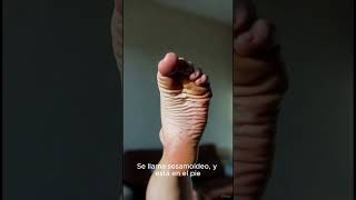 Revisa tu pie #cosasextrañas #historiasraras #oddlyhuman
