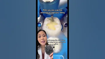 Switching A Silver Filling To A White Filling Cavities Silverfilling Amalgam Dentistry 