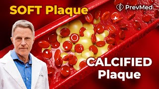 The Difference between Soft plaque and Calcified plaque screenshot 5