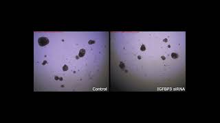 Application of EzScope Live Cell Imaging System – Human Embryonic Lung Organoids│Blue-Ray Biotech