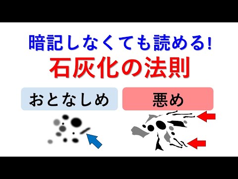 暗記しなくても読める！石灰化の法則　以前の動画、「集簇を制するものは石灰化を制する」の続編です。石灰化の表を丸暗記しなくても読影に困らない、「石灰化のカテゴリー分けの法則」を解説します。