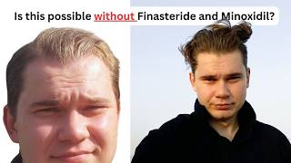The Truth About Reversing Hair Loss Naturally
