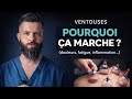 Ref:mHxvp2avGTM Les b�n�fices des ventouses et dans quel cas les utiliser   hijama/ cupping therapy