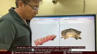 How We Fix Bite Imbalance Without Cutting Your Teeth 🦷 | Digital Occlusal BalancingAdd a heading