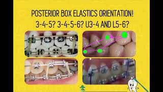 PBE Posterior Box Elastic Orientation