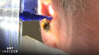 Water Device Painlessly Removes Earwax | Art Insider