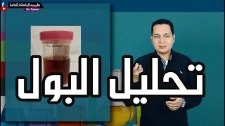 ازاى تقرا تحليل البول