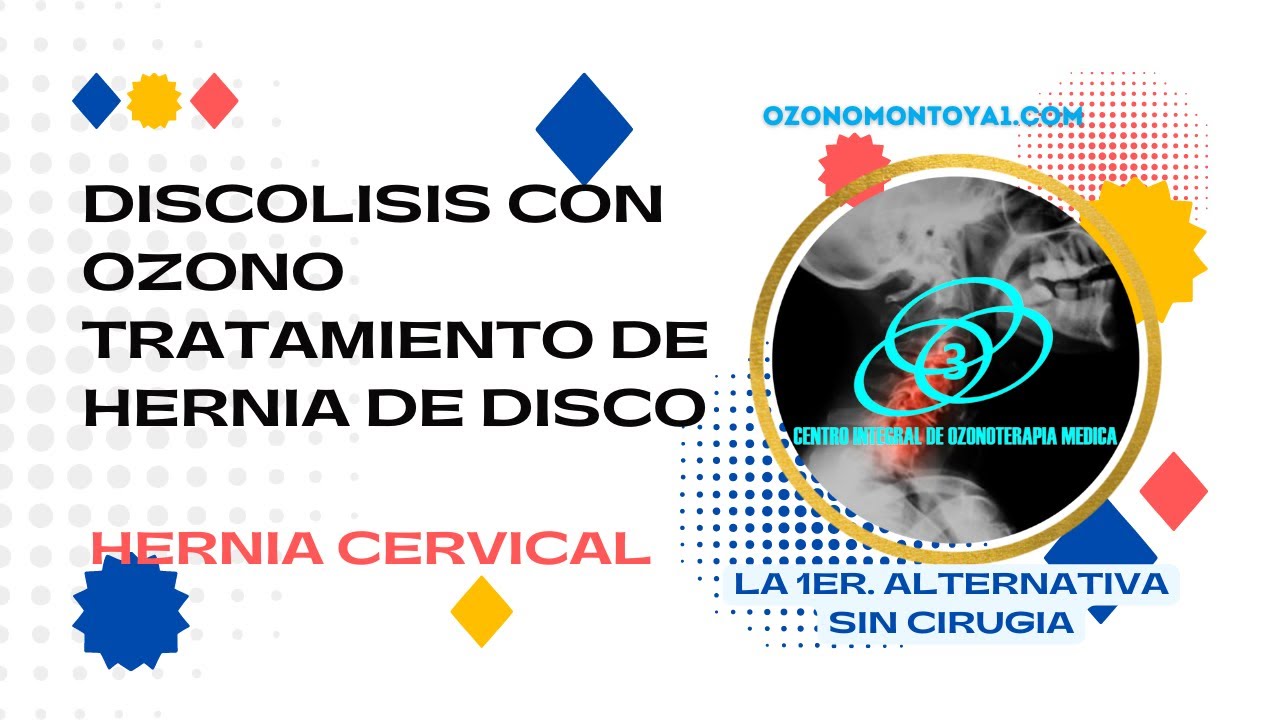 Discolisis Cervical con ozono mexico primera division